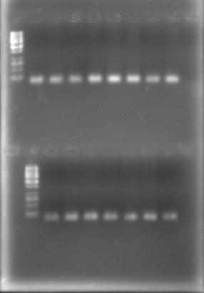 electrophoresis was carried in a vertical unit in 1x TBE buffer. The gels were stained with silver nitrate.