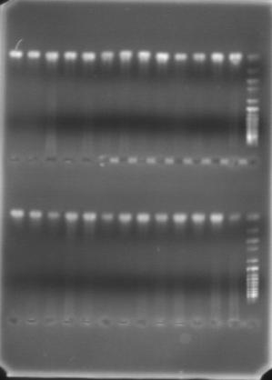 PCR products of exon 4 analysed by electrophoresis in a 1% agarose gel with ethidium bromide staining PCR products of exon 6 analysed by electrophoresis in a 1% agarose gel with ethidium bromide
