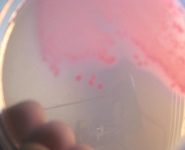Agar culture media showing dark pink colour colonies with