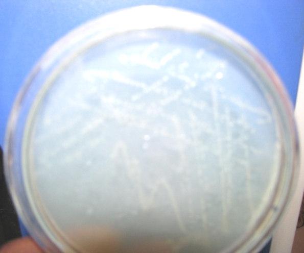 McConkey s Agar culture media showing pink colour colonies