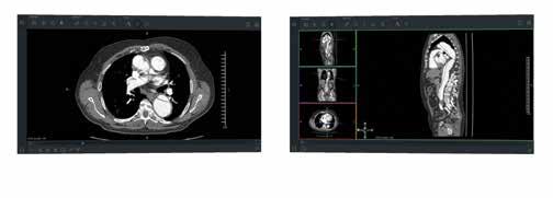 ID/Assigning Authority as well as proprietary non-dicom integration Radiology
