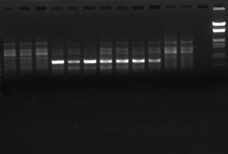 Results Genetic diversity using GTG5 PCR Fingerprinting 3000 2500 2000 1000 750 250 M B 1 2 3 4 5 6 7 8 9 10 11 12 M: Invitrogen 1Kb DNA ladder B: Blank 1: B.