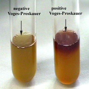 Voges-Proskauer test detects acetoin, an intermediate in the butylene glycol pathway.