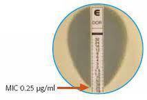 MIC on a stick Plastic strips impregnated with antimicrobial on one side MIC scale on the other side Read MIC where zone of inhibition intersects E strip scale Automated Antimicrobial Susceptibility