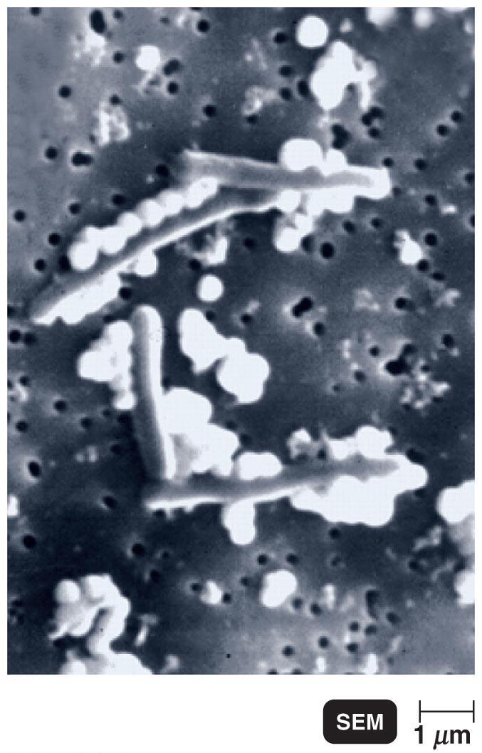 Figure 9.18 Bacillus cells growing on selenium form chains of elemental selenium. Figure 9.20 Using the Ti plasmid as a vector for genetic modification in plants.