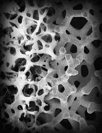 The unique, highly porous, trabecular configuration is conducive to bone formation, enabling rapid and extensive tissue infiltration and strong attachment.