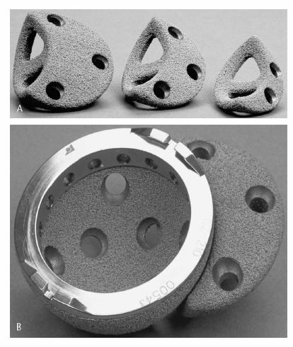 Product Applications Trabecular Metal, a structural biomaterial in many cases, does not require a solid metal substrate and can be fabricated into complex implant shapes.