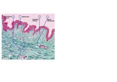 Figure 11: Dermis Figure 12: Injections PRP nappage Papillaris and reticularis dermis Micro-circulation with terminal capillaries ansa Plenty of nerve endings Immune cells: plamocytes, mastocytes