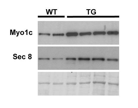 Western blots showing components of GLUT4 trafficking increased in Tg mice From adipose tissue wt tg Myo1c