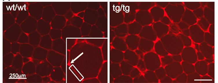 Tm5NM1 increases filamentous actin in