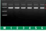 GeneJET Plasmid Purification Kits Rapid isolation of microgram to milligram quantities of highquality plasmid.