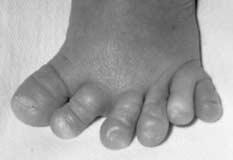12 6 Sometimes babies are born with extra fingers or toes as shown in the photograph.