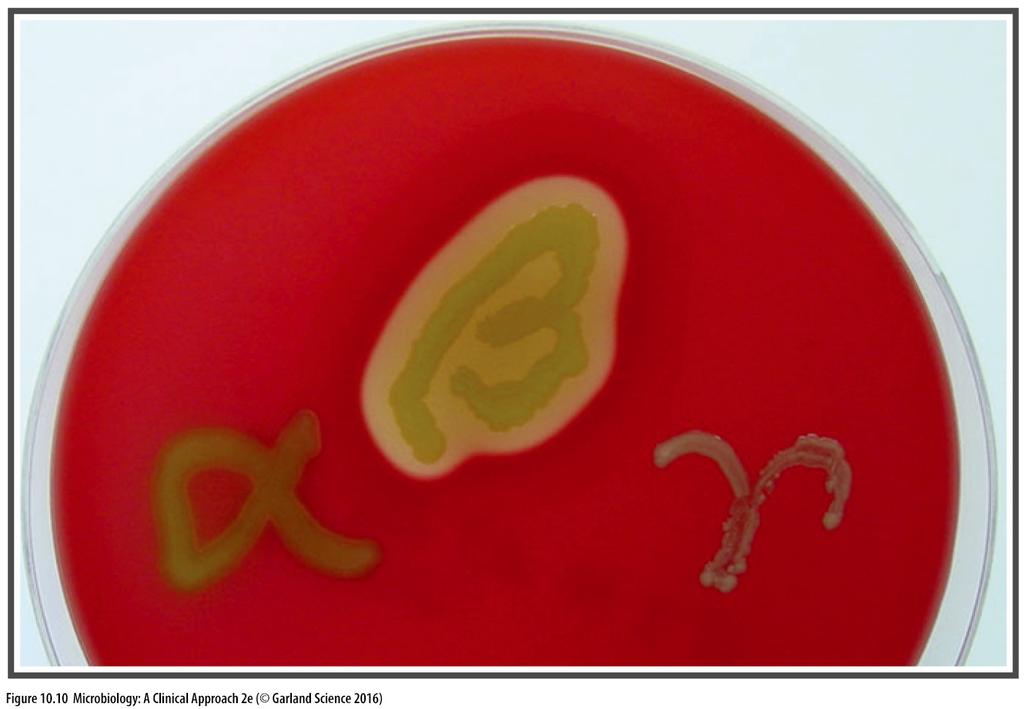 GROWTH MEDIA: Identifying Pathogens Several types of media can identify pathogens Bismuth sulfate agar only grows Salmonella enterica serovar Typhi (causes typhoid fever) Blood agar can differentiate