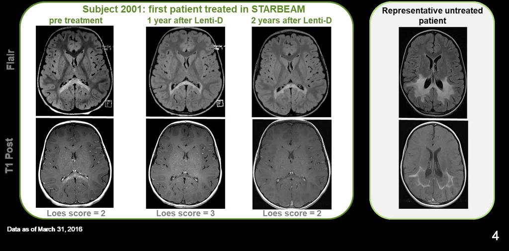 Neuroimaging outcomes demonstrate halting of disease progression