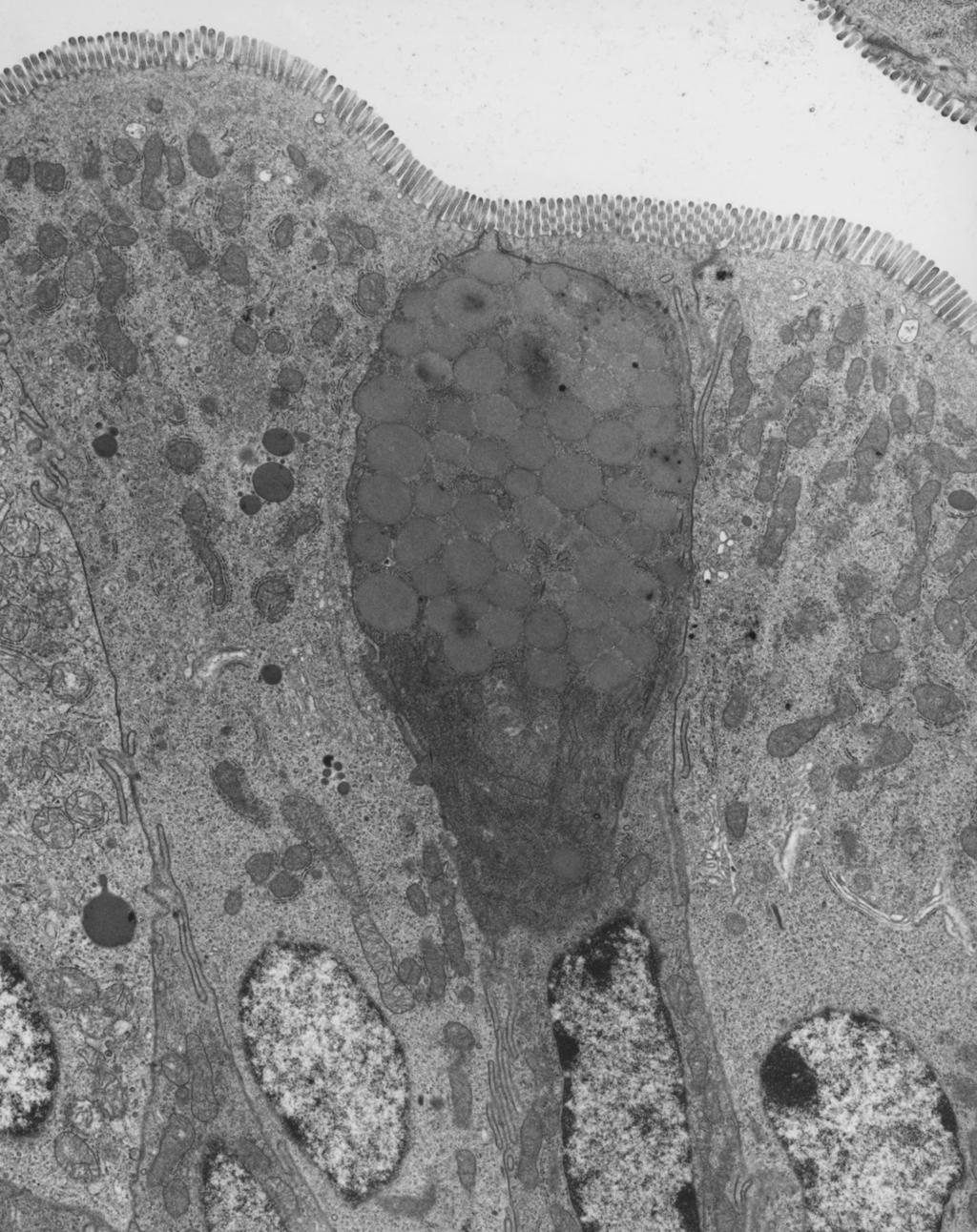 2 Answer all the questions 1 Fig. 1.1 is an electron micrograph of cells from the lining of the small intestine.