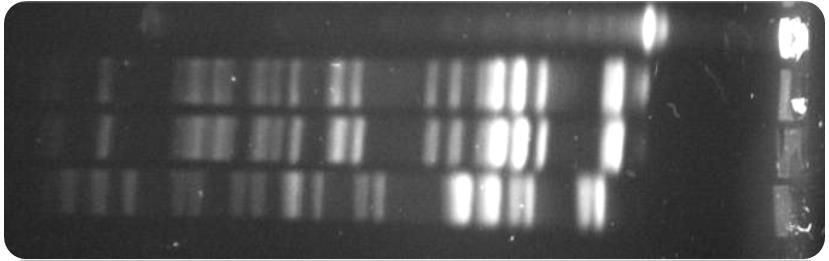 Plasmid-borne antibiotic resistance Plasmid-borne AbR may be acquired very quickly Day3 swab (Serratia TIM R GEN R ) (bla IMP-4