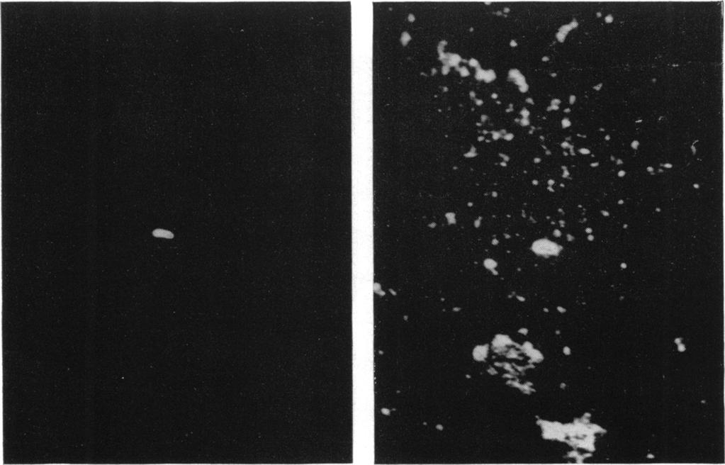 19561 STAINING BACTERIAL SMEARS WITH FLUORESCENT ANTIBODY. II 365 TABLE 2 Detection of Malleomyces pseudomallei in raw soil Number of M. pseudomallei Avg Number of Fluorescent M.