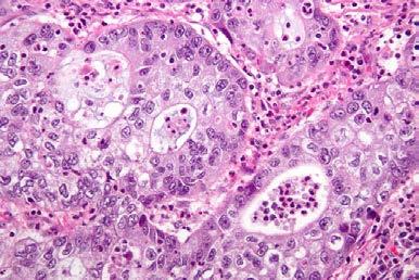 Cell Sciences Histology is the microscopical study of tissue samples to establish the cause of disease Tissue may be taken during surgery or at post mortem Diseases such as cancer are diagnosed by