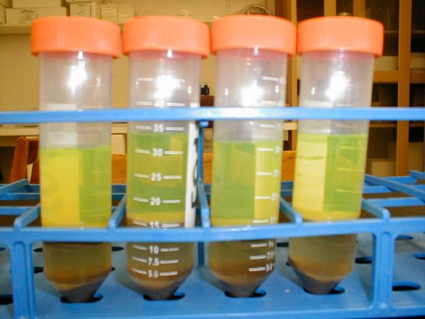 Fig.1 The fluorescent yellow color is produced as microbial enzymatic activity hydrolyzes FDA (colorless) into fluorescein (yellow) and 0 5 µg fluorescein ml-1 standards which were prepared from a 20