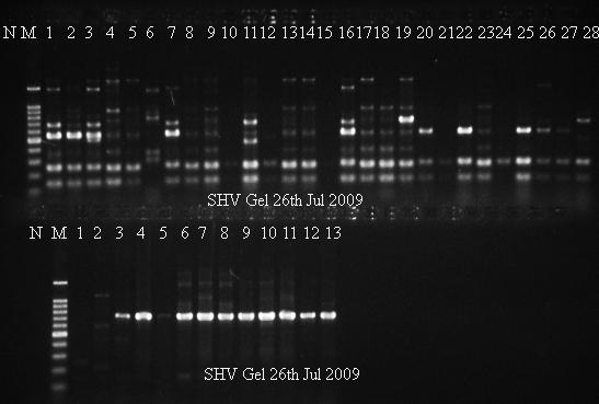 73% of the 40 ESBL positive isolates possessed the bla CTX-M gene. A 100 bp DNA ladder was used as a molecular marker (M).