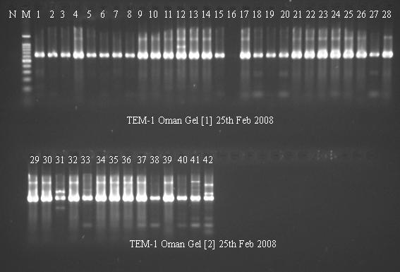 Amplification of TEM: Band size 650 bp Figure 6: PCR gel showing the amplification of the bla TEM gene.