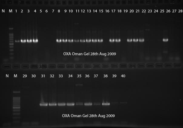 Amplification of OXA: Band size 600 bp Figure 7: PCR gel showing the amplification of the bla OXA gene.
