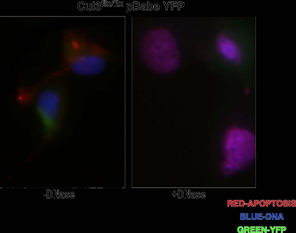 Figure 9. Floxed Fibroblasts infected with YFP under microscope without DNase (left) and with DNase (right).