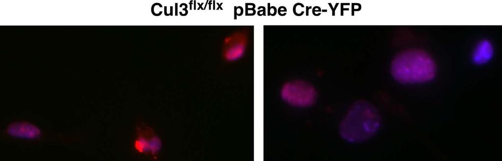 Figure 10. Floxed Fibroblasts infected with Cre-YFP under microscope without DNase (left) and with DNase (right). Figure 10 shows fibroblasts infected with Cre recombinase and YFP.