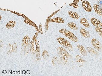 Virtually all surface epithelial cells show a strong cytoplasmic staining reaction, while most crypt cells display an at least weak to moderate staining reaction.