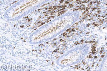 Fig 4a Staining for CD38 of the appendix using the mab clone 5F7.