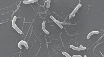 Experts in bacterial culturing at Biotechnology Solutions can help you identify the key nutrients and environmental