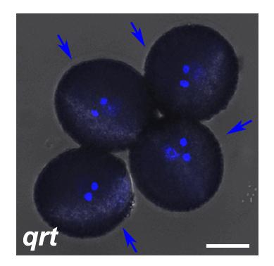 Supplementary Fig 4 Mature pollen grains of the qrt1 mutant. This picture is merged from a bright-field and a DAPI-staining UV image.
