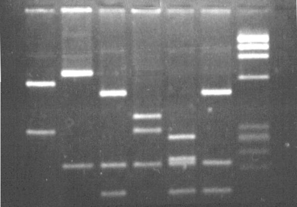 Reading Gels Direction of DNA Movement Ideal Gel