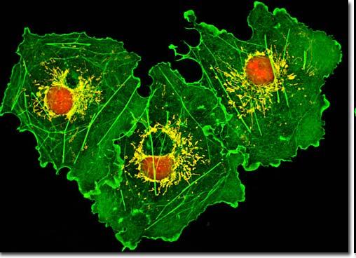 actin Cos-7 Cells Orange = nucleus Green = actin