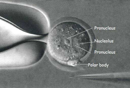 1 - injecting the construct into the pronucleus of a fertilized mouse egg Only for