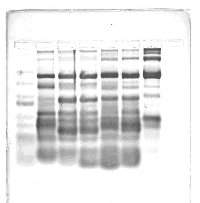 Can Proteins be Separated on Agarose Gels?