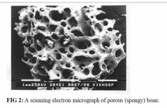 Porous Ceramics Advantage: Inertness Mechanical stability of implant (bone ingrowth at poresize>100µm) Disadvantage Restricition to non-load bearing applications Weaker, larger surface exposed