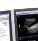 doing a variety of ultrasound reporting with reports for: