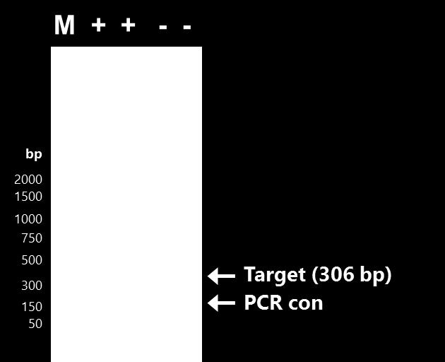 The size of the ASBVd target amplicon corresponds to the 230 bp band represented by the provided DNA Marker (M). E.