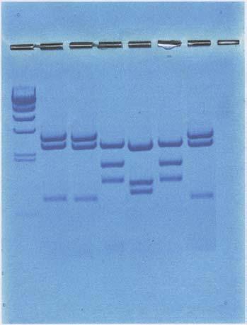 Picture 1 - Results of gel electrophoresis (a) and interpretation of these results in terms of Hedgehog re-colonisation (b).