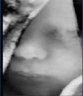 ULTRASONIC IMAGING Acoustic Image of an unborn Child O. Shechner, M. Sheinovitz, M. Feinberg, H.