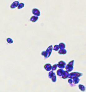 parasites Multinucleated