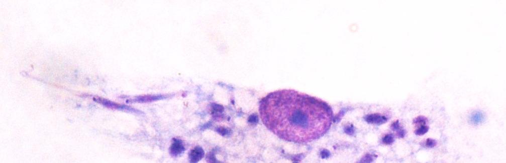 LdCen1 -/- parasites