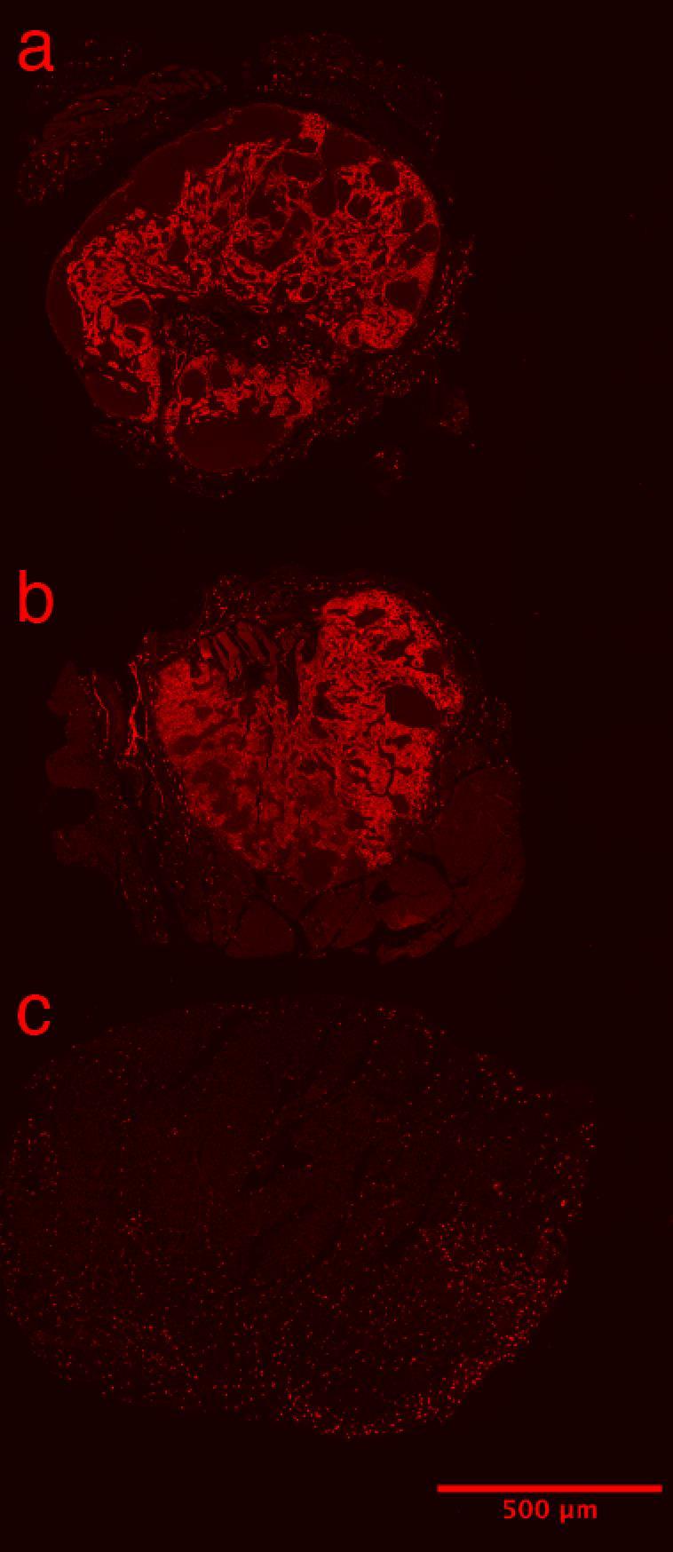 Supplementary Figure 10 Resected Tissue LYVE-1 Immunofluorescence. Lyve-1 staining of a slide containing slices of the three resected tissues.
