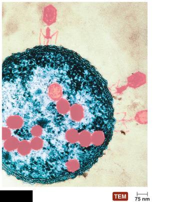 Figure 1.9 A colorized electron microscope image of viruses infecting a bacterium.