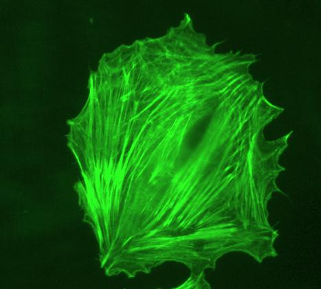 2 B16 mouse melanoma cell imaged using JPK NanoWizard mounted on Zeis Axiovert 200 inverted optical microscope. Upper panel YFP fluorescence.