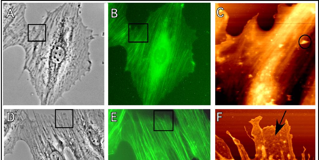 Fig. 5 Combination of optical and AFM images of fibroblasts treated with hydrogen peroxide.