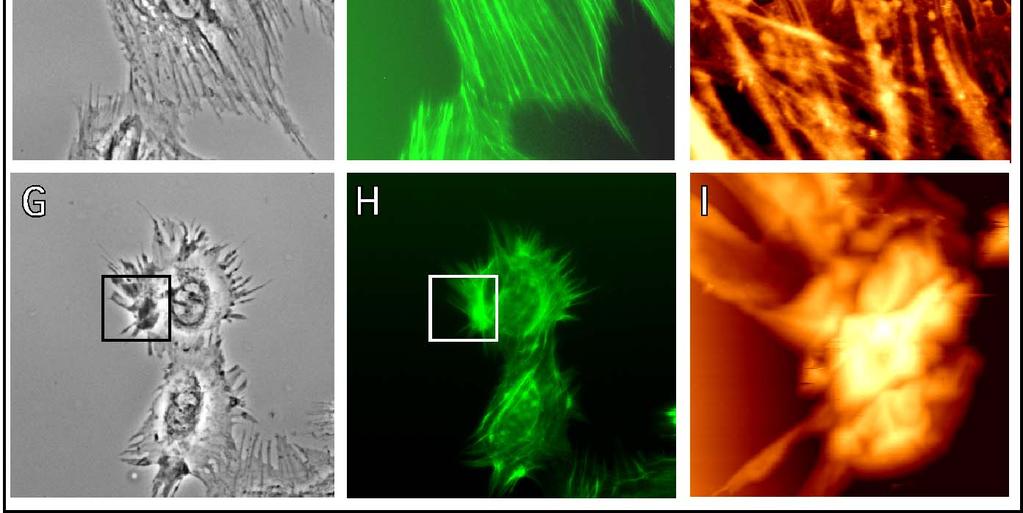 hour before fixation. Phase contrast images (A,D,G) and epifluorescence from FITC-phalloidin labelled actin filaments (B,E,H) show the same scan area for each case.