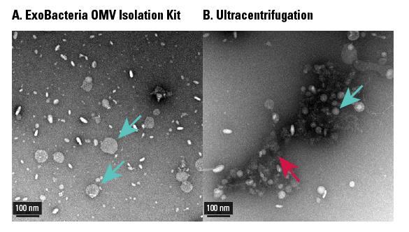 Example Data and Applications Figure 1. OMVs isolated using the ExoBacteria OMV Isolation Kit are similar in appearance, but with tighter distribution than OMVs isolated via ultracentrifugation.