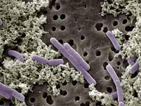 Gram Positive Bacteria: cause many